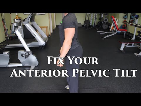 The BEST Way To FIX An Anterior Pelvic Tilt | W/ Lumbar Hyperlordosis